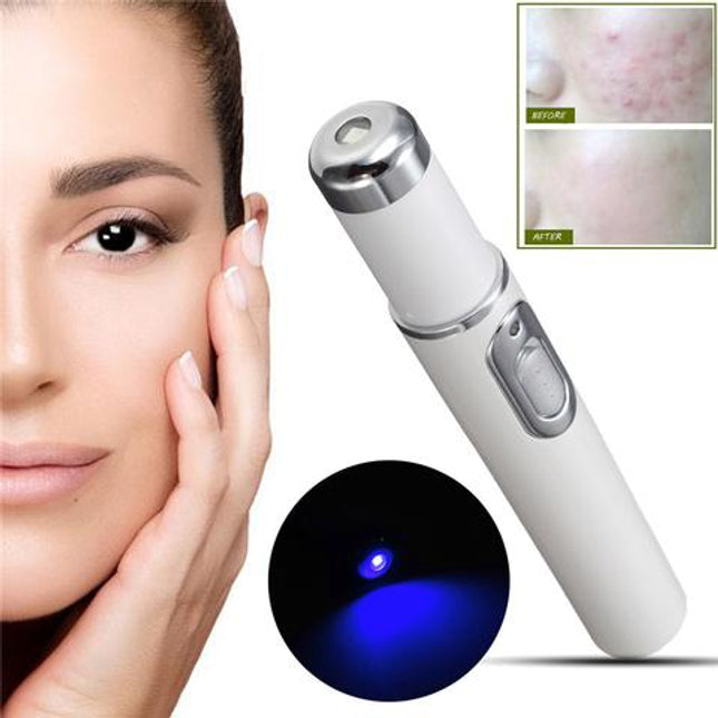 Acne Scar Removal Laser Pen Beauty Pen